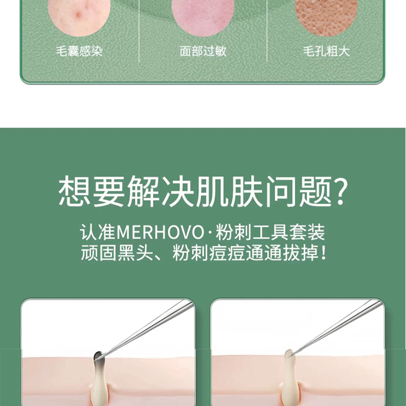 Acne needle blackhead cell clip suit acne acne acne needle tweezers precision acne clip acne tool artifact