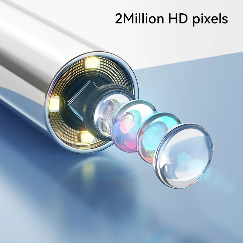 1.38'' Ear Camera Wit IPS Display and 1080P Camera Ear Check Portable Inspector for Ear Mouth Pet With 12tips Replaceable Tools