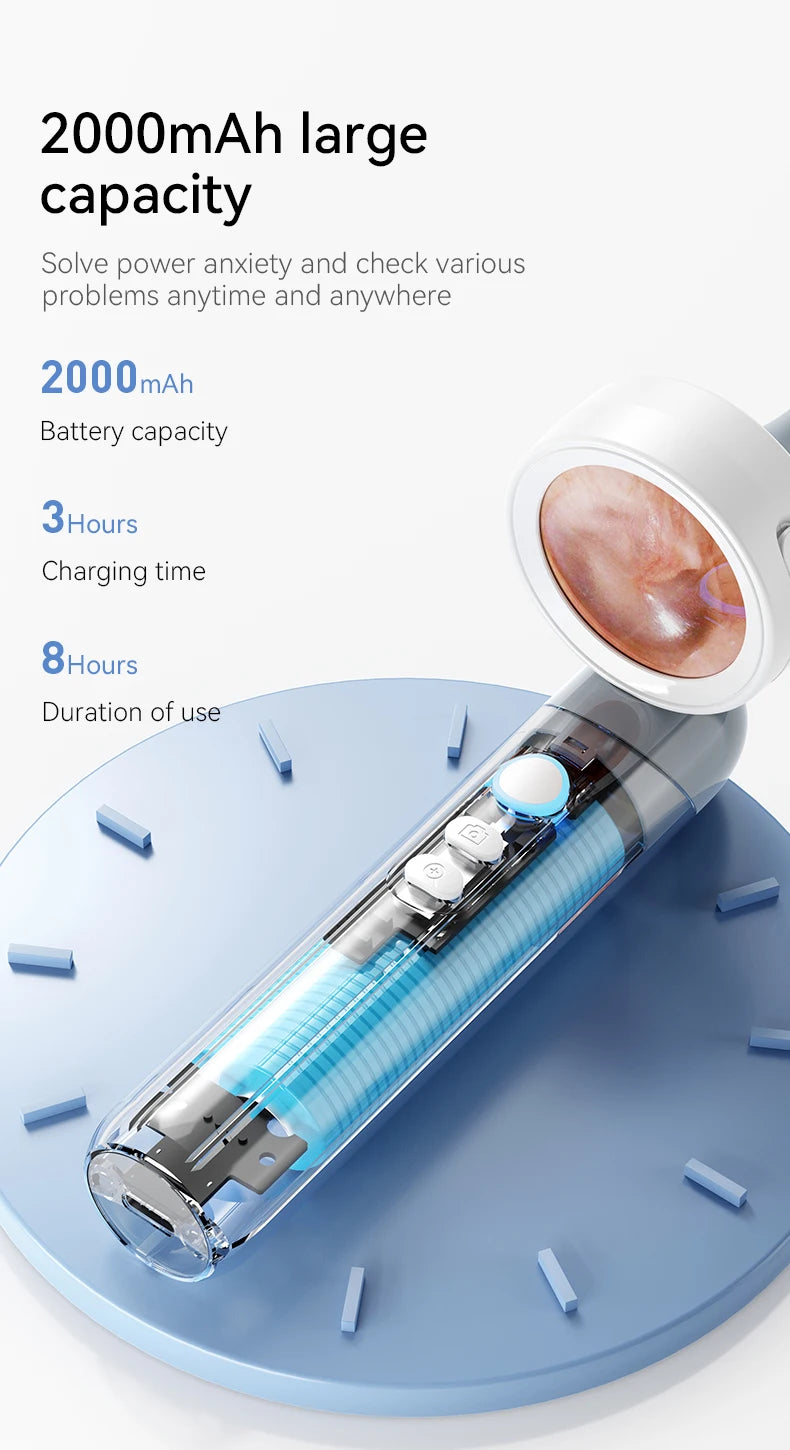 1.38'' Ear Camera Wit IPS Display and 1080P Camera Ear Check Portable Inspector for Ear Mouth Pet With 12tips Replaceable Tools