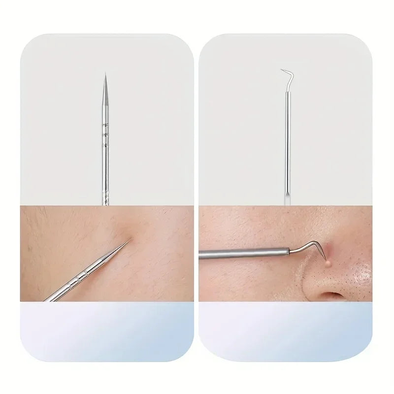 Optional 4Pcs 7Pcs 8Pcs Stainless Steel Skin Care Tool Set For Blackhead And Pimple Household Salon Grooming Accessory