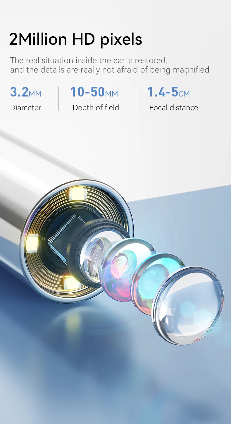 1.38'' Ear Camera Wit IPS Display and 1080P Camera Ear Check Portable Inspector for Ear Mouth Pet With 12tips Replaceable Tools