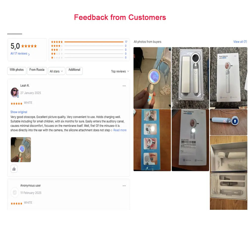 1.38'' Ear Camera Wit IPS Display and 1080P Camera Ear Check Portable Inspector for Ear Mouth Pet With 12tips Replaceable Tools
